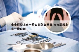 宝宝屁股上有一片白斑怎么回事 宝宝屁股上有一块白斑