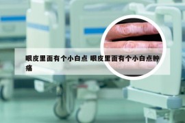 眼皮里面有个小白点 眼皮里面有个小白点肿痛