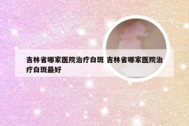 吉林省哪家医院治疗白斑 吉林省哪家医院治疗白斑最好