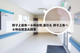 脖子上面有一小块白斑,是什么 脖子上有一小块白斑怎么回事