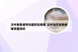汉中银屑病专科医院在哪里 汉中治疗皮肤病哪家医院好