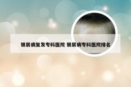 银屑病复发专科医院 银屑病专科医院排名