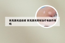 氦氖激光适应症 氦氖激光照射治疗有副作用吗