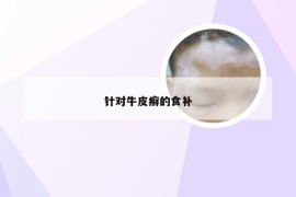针对牛皮癣的食补