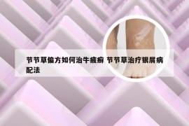 节节草偏方如何治牛疲癣 节节草治疗银屑病配法