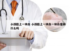 小孩脸上一块白 小孩脸上一块白一块白是缺什么吗