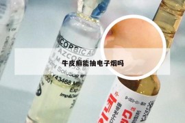 牛皮癣能抽电子烟吗