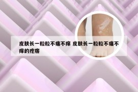 皮肤长一粒粒不痛不痒 皮肤长一粒粒不痛不痒的疙瘩