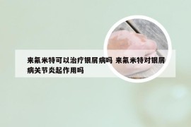 来氟米特可以治疗银屑病吗 来氟米特对银屑病关节炎起作用吗