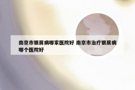 南京市银屑病哪家医院好 南京市治疗银屑病哪个医院好