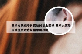 昆明皮肤病专科医院诚挚太医堂 昆明太医堂皮肤医院治疗灰指甲可以吗