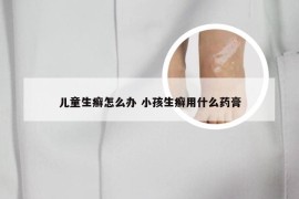 儿童生癣怎么办 小孩生癣用什么药膏
