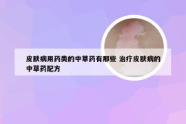 皮肤病用药类的中草药有那些 治疗皮肤病的中草药配方
