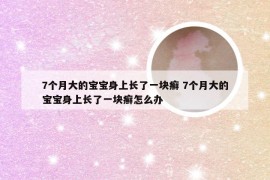 7个月大的宝宝身上长了一块癣 7个月大的宝宝身上长了一块癣怎么办