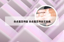 白点是否传染 白点是否传染艾滋病