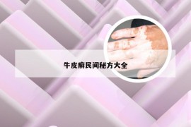 牛皮癣民间秘方大全