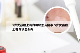 5岁女孩脸上有白斑块怎么回事 5岁女孩脸上有白块怎么办