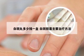 白斑丸多少钱一盒 白斑胶囊主要治疗方法