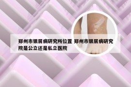 郑州市银屑病研究所位置 郑州市银屑病研究院是公立还是私立医院