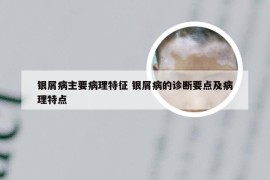 银屑病主要病理特征 银屑病的诊断要点及病理特点