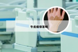 牛皮癣带茶喝