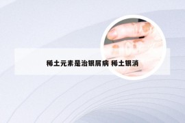 稀土元素是治银屑病 稀土银消