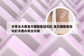 内蒙古大唐复方醋酸氟轻松酊 复方醋酸氟轻松酊大唐内蒙古价格