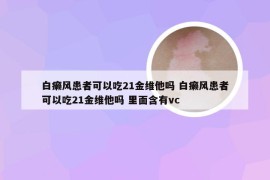 白癞风患者可以吃21金维他吗 白癞风患者可以吃21金维他吗 里面含有vc