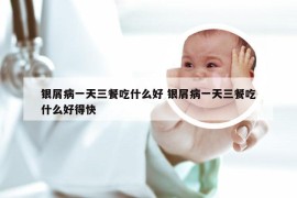 银屑病一天三餐吃什么好 银屑病一天三餐吃什么好得快