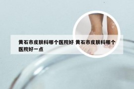 黄石市皮肤科哪个医院好 黄石市皮肤科哪个医院好一点