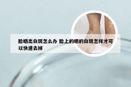脸晒出白斑怎么办 脸上的晒的白斑怎样才可以快速去掉