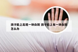 孩子脸上出现一块白斑 孩子脸上有一块白斑怎么办