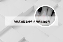 白殿疯病能治好吗 白殿疯能自愈吗