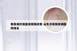 银屑病济南医保报销政策 山东济南银屑病医院排名
