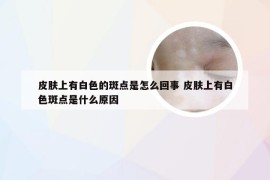 皮肤上有白色的斑点是怎么回事 皮肤上有白色斑点是什么原因