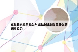 皮肤越来越差怎么办 皮肤越来越差是什么原因导致的