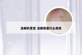 洁癣的意思 洁癖症是什么症状