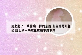 腿上起了一块像癣一样的东西,去皮后是红色的 腿上长一块红色皮癣不疼不痒