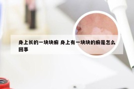 身上长的一块块癣 身上有一块块的癣是怎么回事