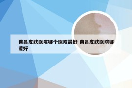 南昌皮肤医院哪个医院最好 南昌皮肤医院哪家好