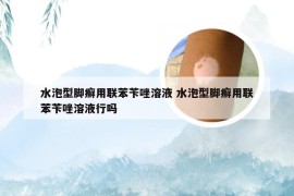 水泡型脚癣用联苯苄唑溶液 水泡型脚癣用联苯苄唑溶液行吗