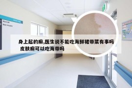 身上起的癣,医生说不能吃海鲜裙带菜有事吗 皮肤癣可以吃海带吗