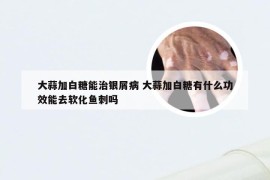 大蒜加白糖能治银屑病 大蒜加白糖有什么功效能去软化鱼刺吗