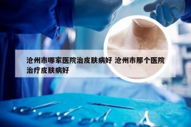 沧州市哪家医院治皮肤病好 沧州市那个医院治疗皮肤病好