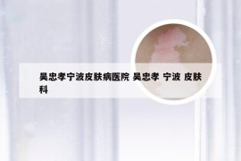 吴忠孝宁波皮肤病医院 吴忠孝 宁波 皮肤科