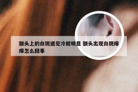额头上的白斑遇见冷就明显 额头出现白斑痒痒怎么回事