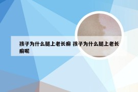 孩子为什么腿上老长癣 孩子为什么腿上老长癣呢