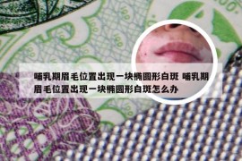 哺乳期眉毛位置出现一块椭圆形白斑 哺乳期眉毛位置出现一块椭圆形白斑怎么办