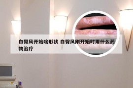 白臀风开始啥形状 白臀风刚开始时用什么药物治疗