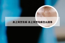 身上突然生癣 身上突然生癣怎么回事